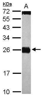 CIDEC Antibody in Western Blot (WB)