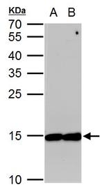 eIF5A Antibody in Western Blot (WB)