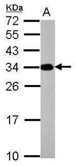 V-ATPase E2 Antibody in Western Blot (WB)