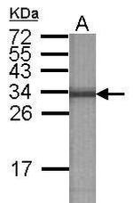 V-ATPase E2 Antibody in Western Blot (WB)