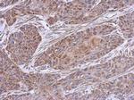 NDUFB4 Antibody in Immunohistochemistry (Paraffin) (IHC (P))