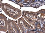 PI3K p85 alpha Antibody in Immunohistochemistry (Paraffin) (IHC (P))