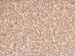 PAK1 Antibody in Immunohistochemistry (Paraffin) (IHC (P))