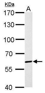 PAK1 Antibody in Western Blot (WB)