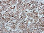 TID1 Antibody in Immunohistochemistry (Paraffin) (IHC (P))