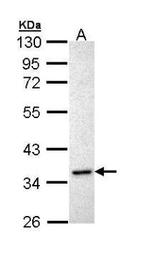 INHA Antibody in Western Blot (WB)