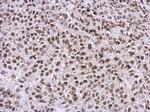 NCK1 Antibody in Immunohistochemistry (Paraffin) (IHC (P))