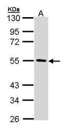 HIPPI Antibody in Western Blot (WB)