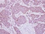 MEK5 Antibody in Immunohistochemistry (Paraffin) (IHC (P))