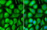 TRAF2 Antibody in Immunocytochemistry (ICC/IF)