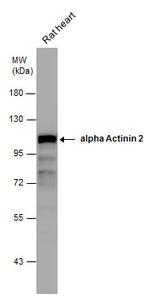 alpha Actinin 2 Antibody in Western Blot (WB)