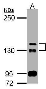 TAOK2 Antibody in Western Blot (WB)