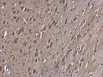 GSK3B Antibody in Immunohistochemistry (Paraffin) (IHC (P))