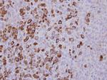 XIAP Antibody in Immunohistochemistry (Paraffin) (IHC (P))