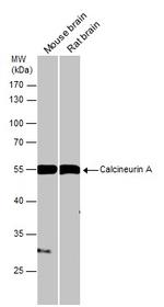 Calcineurin A Antibody in Western Blot (WB)