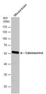 Calcineurin A Antibody in Western Blot (WB)