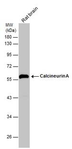 Calcineurin A Antibody in Western Blot (WB)