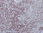 STEP Antibody in Immunohistochemistry (Paraffin) (IHC (P))