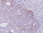 ErbB4 Antibody in Immunohistochemistry (Paraffin) (IHC (P))