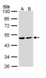 PPM1A Antibody in Western Blot (WB)