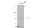 PLCG2 Antibody in Western Blot (WB)