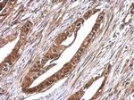 RUVBL1 Antibody in Immunohistochemistry (Paraffin) (IHC (P))