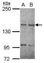 RET Antibody in Western Blot (WB)