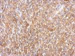 MEK2 Antibody in Immunohistochemistry (Paraffin) (IHC (P))