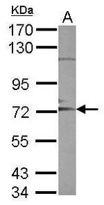 ADAM10 Antibody in Western Blot (WB)