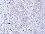 DGKG Antibody in Immunohistochemistry (Paraffin) (IHC (P))