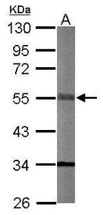 STK40 Antibody in Western Blot (WB)