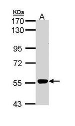 MPP2 Antibody in Western Blot (WB)