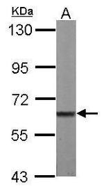 MPP2 Antibody in Western Blot (WB)