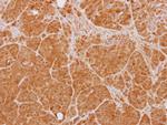 PTK9 Antibody in Immunohistochemistry (Paraffin) (IHC (P))