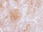 MYLK2 Antibody in Immunohistochemistry (Paraffin) (IHC (P))