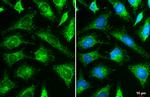 HK2 Antibody in Immunocytochemistry (ICC/IF)