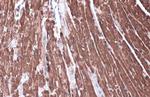 HK2 Antibody in Immunohistochemistry (Paraffin) (IHC (P))