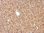 HK2 Antibody in Immunohistochemistry (Paraffin) (IHC (P))