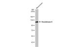 HK2 Antibody in Western Blot (WB)