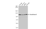 HK2 Antibody in Western Blot (WB)