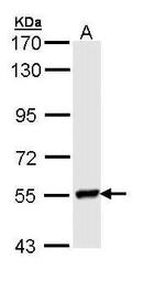 Lyn Antibody in Western Blot (WB)