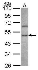 PHKG2 Antibody in Western Blot (WB)