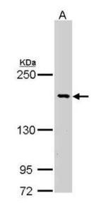 BCR Antibody in Western Blot (WB)