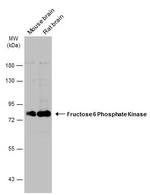 PFKM Antibody in Western Blot (WB)