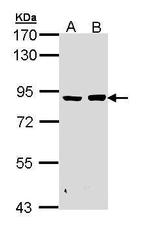 PFKM Antibody in Western Blot (WB)