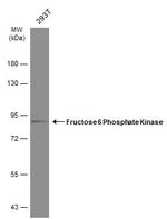 PFKM Antibody in Western Blot (WB)