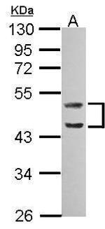 Caspase 1 Antibody in Western Blot (WB)