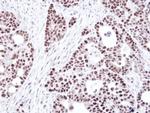 MSH6 Antibody in Immunohistochemistry (Paraffin) (IHC (P))