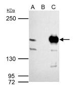 MSH6 Antibody in Immunoprecipitation (IP)