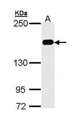 MSH6 Antibody in Western Blot (WB)